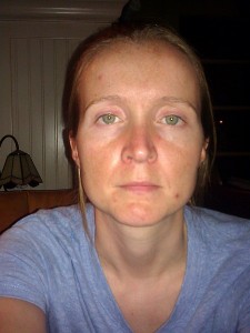 before-MaxClarity before shot MaxClarity trial