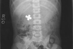 swallowed a cross