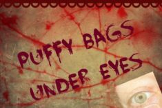 How to reduce bags under eyes