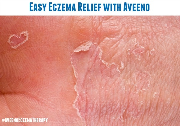 Easy Eczema Relief #AveenoEczemaTherapy #MC