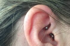 I tried a daith piercing for migraines. Check out my story!