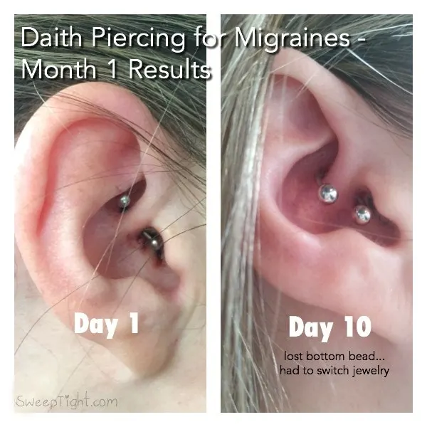 Ears with a pierced daith. 