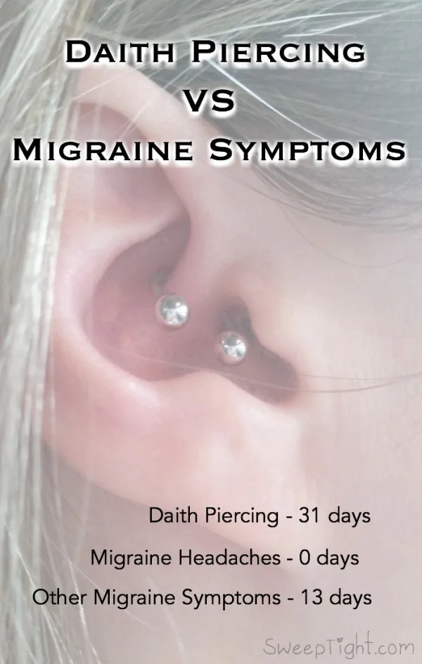 Pressure point earring for on sale migraine