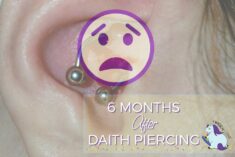 6 Months of results after daith piercing for migraines.