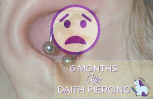 6 Months of results after daith piercing for migraines.