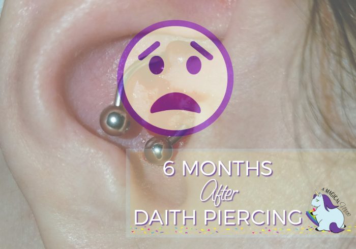 Picture of an ear with a daith piercing for migraines.