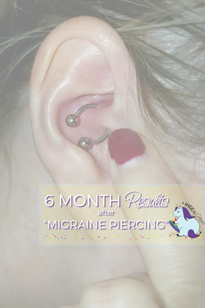 Daith earring in an ear.