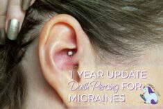 Migraine Piercing - 1 Year Results After Daith Piercing for Headaches