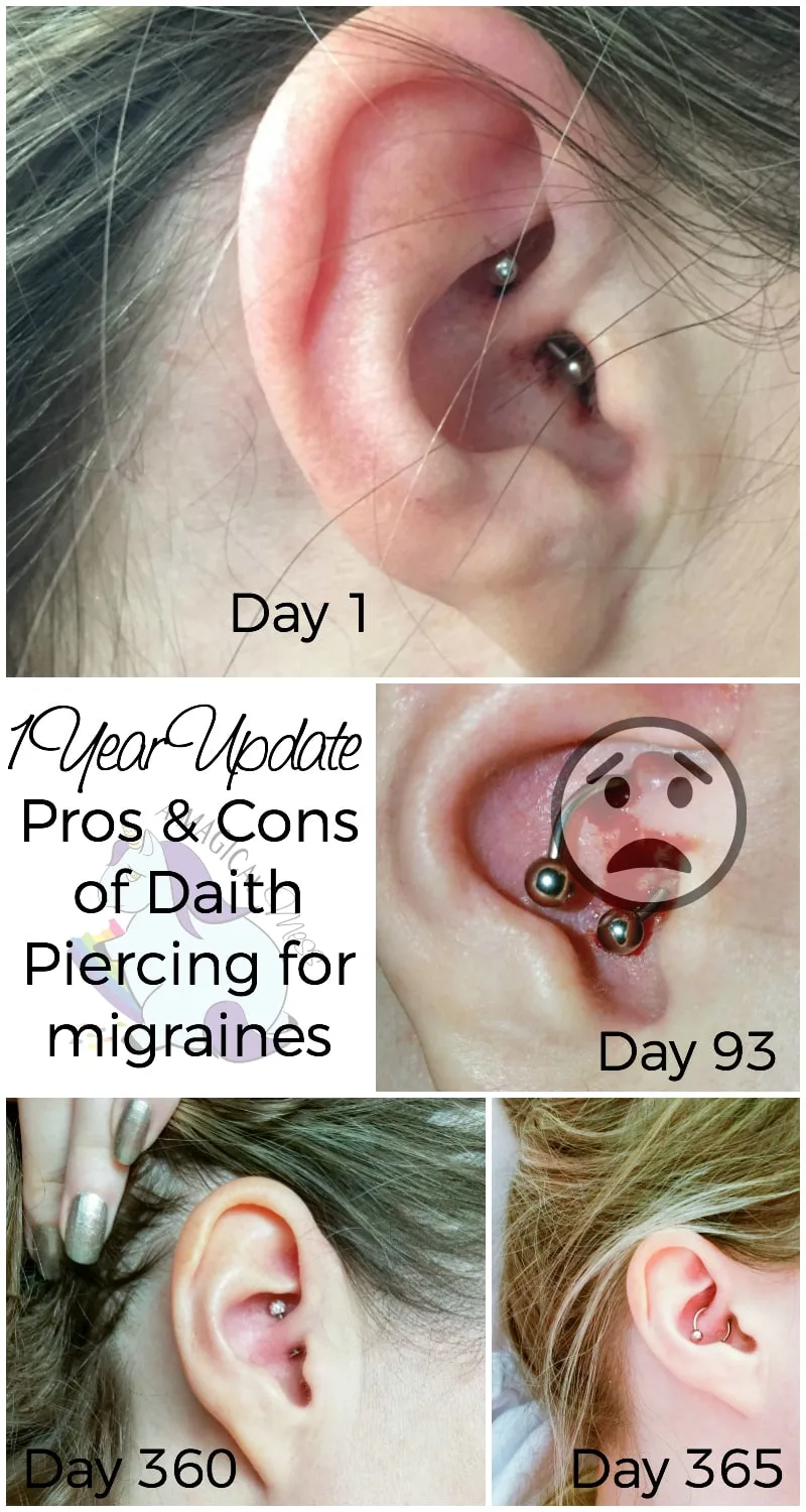 Can Tragus Or Daith Piercings Help With Migraine Relief?