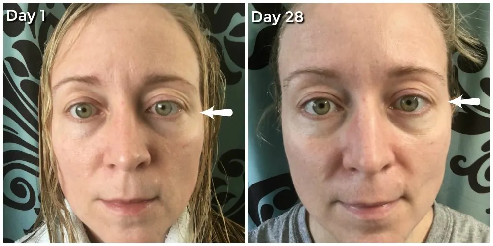 28 days of Olay study - before and after. Definitely notice in my crow's feet!