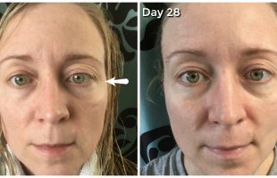 28 days of Olay study - before and after. Definitely notice in my crow's feet!
