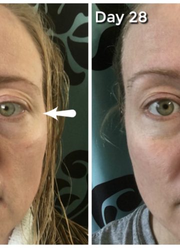 Aging Skin Problems and How I am Fighting Them