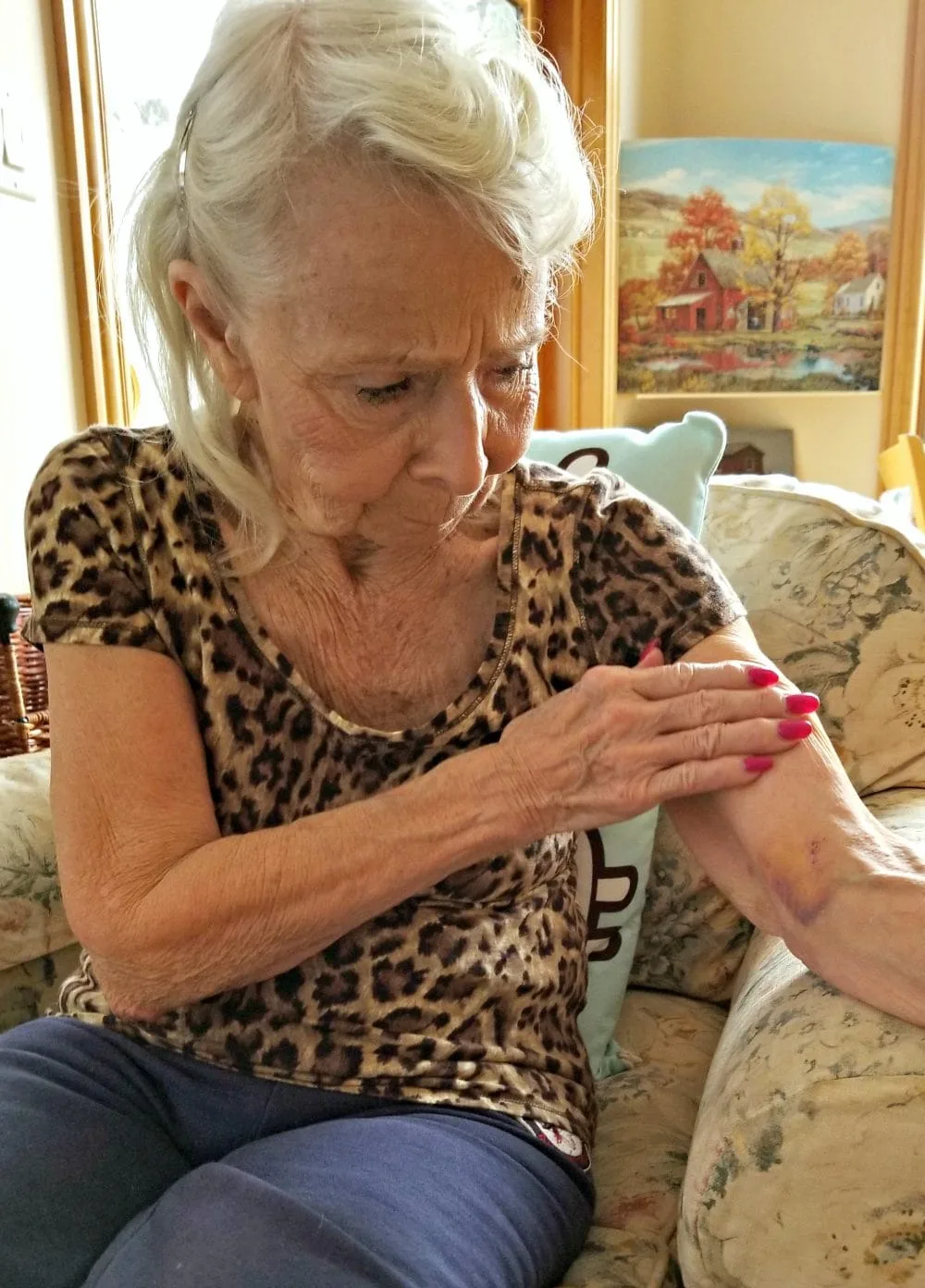 Gram with a nasty bruise on her arm. :( 