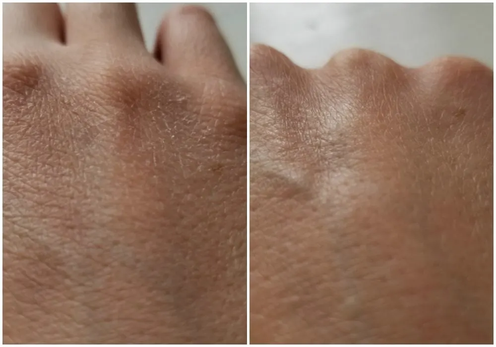 Closeup of skin on hands. 