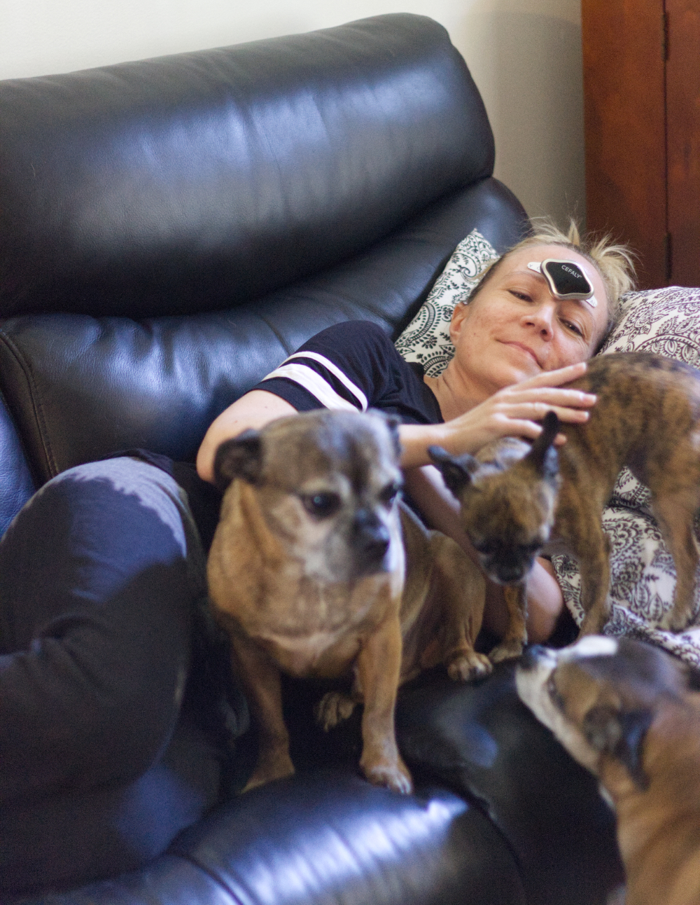 Woman wearing a cefaly device surrounded by dogs on a couch.